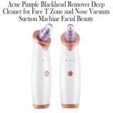 Acne Pimple Blackhead Remover Deep Cleaner fo Face- USB Charging - Normabest