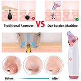 Acne Pimple Blackhead Remover Deep Cleaner fo Face- USB Charging - Normabest