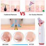  Suction Blackhead Eliminator