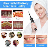 USB Rechargeable Electric Dental Calculus Tooth Cleaner with LED HD Screen - Normabest