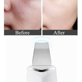 Ultra-Sonic Deep Facial Cleansing Machine Facial Scrubber- USB Charging - Normabest