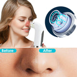 USB Rechargeable Electric Pore Blackhead Vacuum Cleaner - Normabest