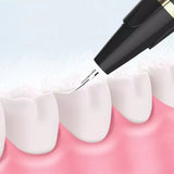 USB Charging Electric Ultrasonic Dental Callous Remover - Normabest