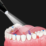 USB Charging Electric Ultrasonic Dental Callous Remover - Normabest