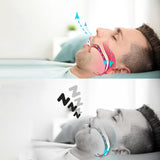 Anti-Snoring Corrective Breath Positioning Mouth Night Guard - Normabest