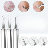 15Pcs  Stainless Steel Blackhead Remover Pimple Popper Tools Kit with Metal Case - Normabest