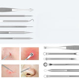 15Pcs  Stainless Steel Blackhead Remover Pimple Popper Tools Kit with Metal Case - Normabest